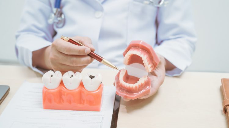 Dentist demonstrating the Truth About Cavities with a teeth model and pen.